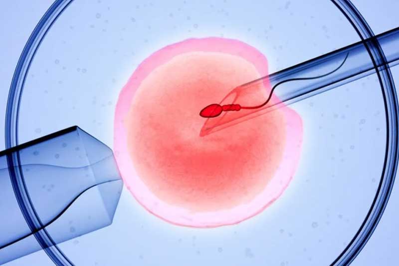 IVF