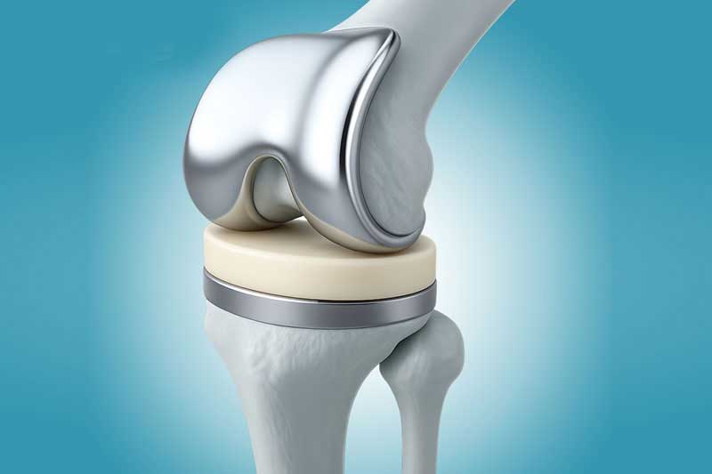 Orthopedics